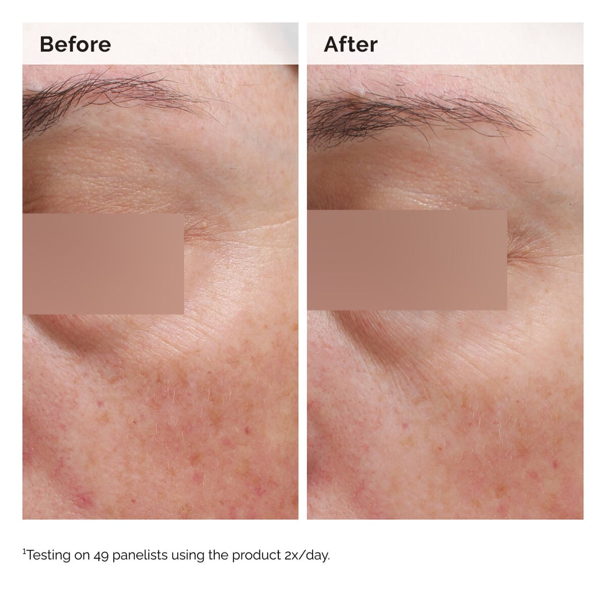 niacinamide-5-face-and-body-emulsion-c8 2024-08-23-ORD-Nia-5pct-Face-Body-B-A-Elasticity-Global-02-1x1.jpg