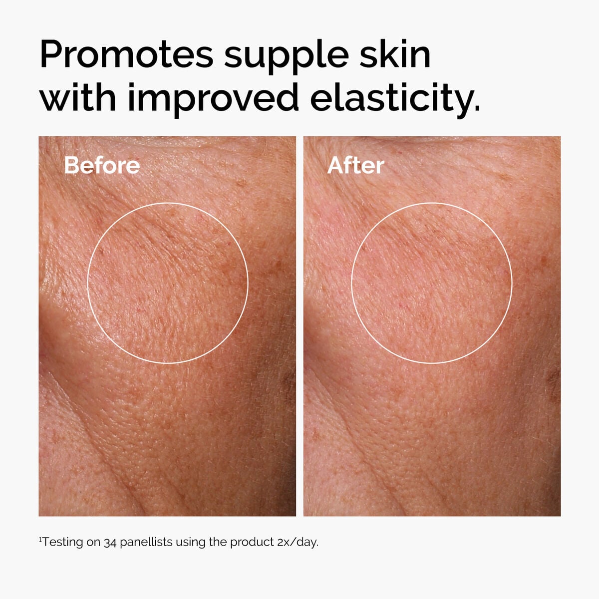 hyaluronic-acid-2-b5-with-ceramides-p4 ord-hyaluronic-acid-2pct-b5-hydrating-serum-before-after-elasticity.jpg