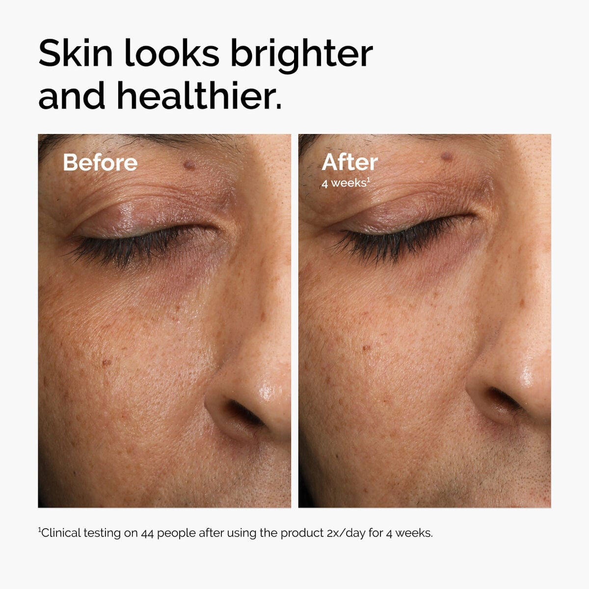 multi-antioxidant-radiance-serum-q8 ord-mars-before-after-healthy.jpg