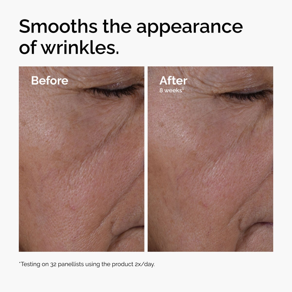 multi-peptide-ha-serum-h3 ord-multi-peptide-ha-serum-wrinkles-before-after.jpg
