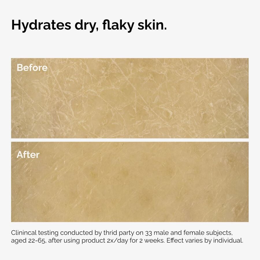 the-body-care-collection-f4 ord-natural-moisturizing-factors-inulin-body-before-after-graphic-02.jpg