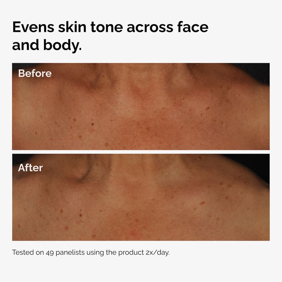 the-body-care-collection-f4 ord-niacinamide-face-body-serum-before-after-even-tone-graphic.jpg