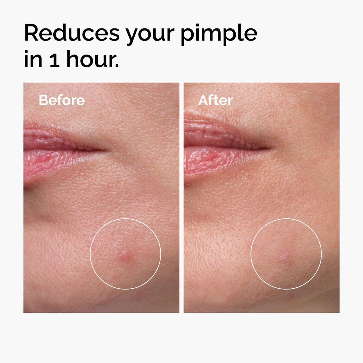 sulfur-10-powder-to-cream-concentrate-w4 ord-sulfur-10pct-powder-to-cream-concentrate-before-after-NA.jpg